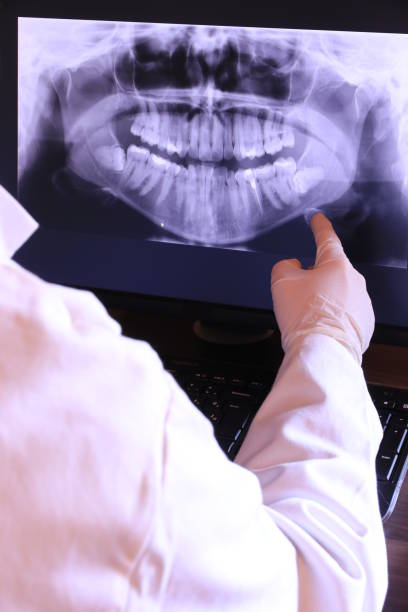 Best Emergency Root Canal Treatment in Carlyle, IL